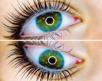 Lash lift